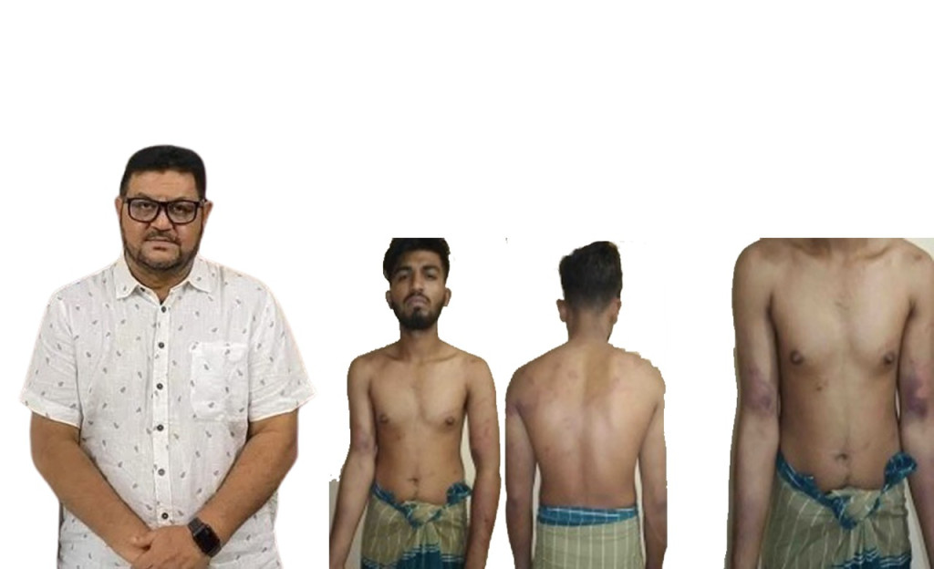 আওয়ামীলীগের দোসর জাকির মুন্সি মধ্যযুগীয় কায়দায় নির্যাতন করেন