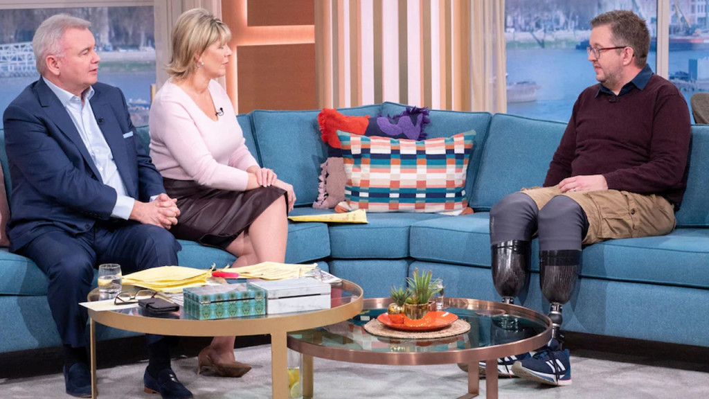 বিমার অর্থ পেতে নিজের পা কেটে ফেললেন ব্রিটিশ সার্জন!