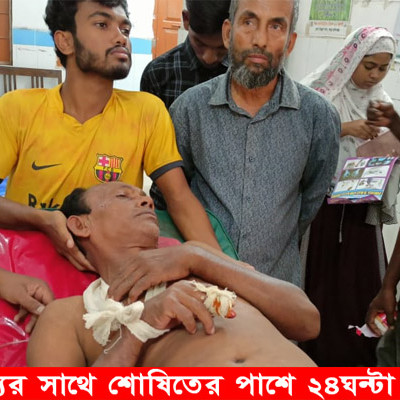 নড়াইলে কুকুরের কামড়ে আহত ৭জন