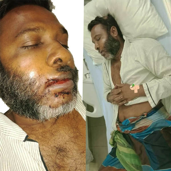 নলদীতে জামায়াত নেতার উপর সন্ত্রাসী হামলা, আশঙ্কাজনক অবস্থায় হাসপাতালে